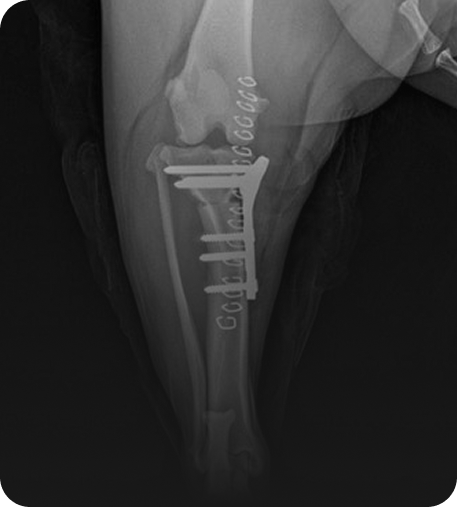 슬개골·십자인대·골절 수술
